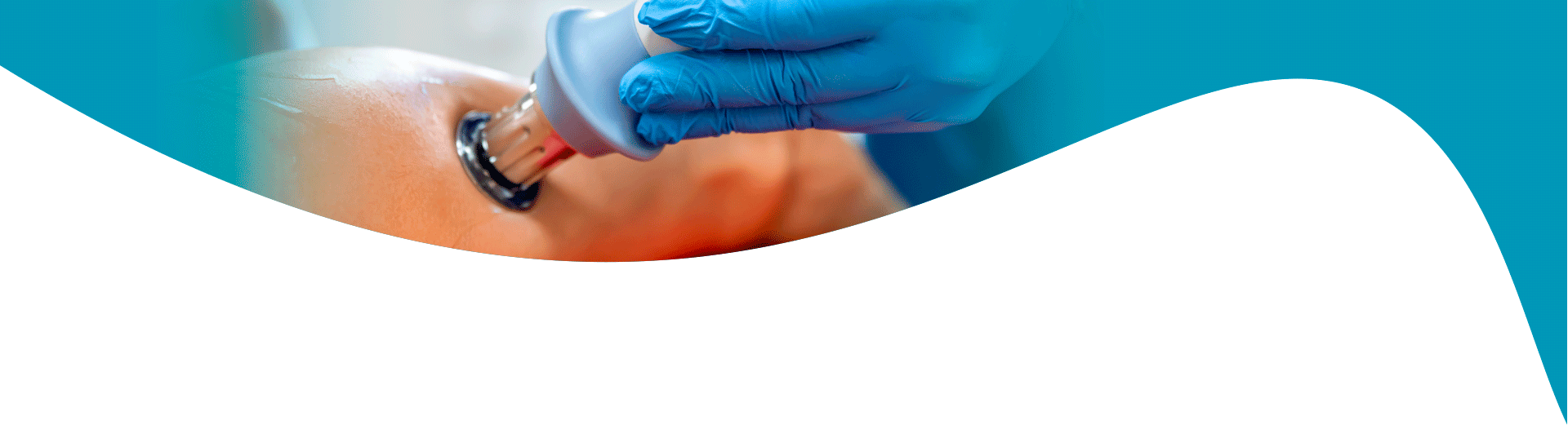 fisioestética en málaga