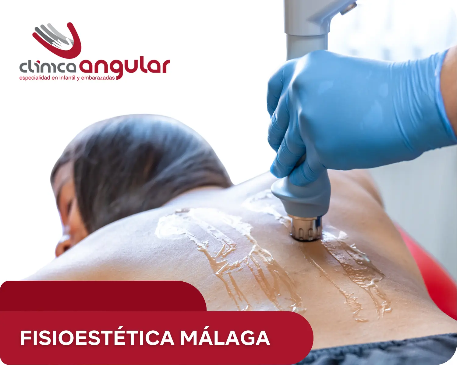 tratamiento de fisioestética en málaga