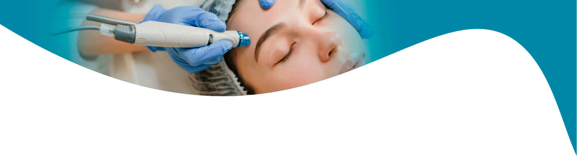 beneficios dermapen