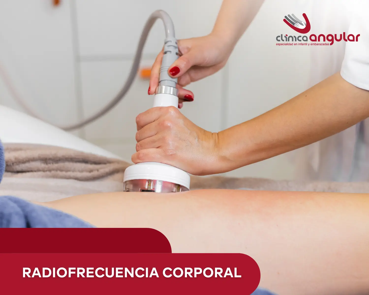 radiofrecuencia en cuerpo